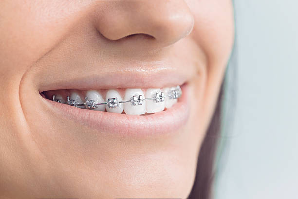 Best Tooth Extraction  in Kingstown, MD